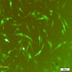 GFP Expressing Mouse Cells (87)